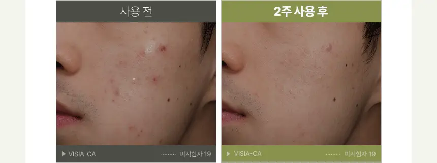 [쿨링진정]메이크프렘 인테카 포맨 수딩 올인원 200ml (기획/단품) 상세페이지 29
